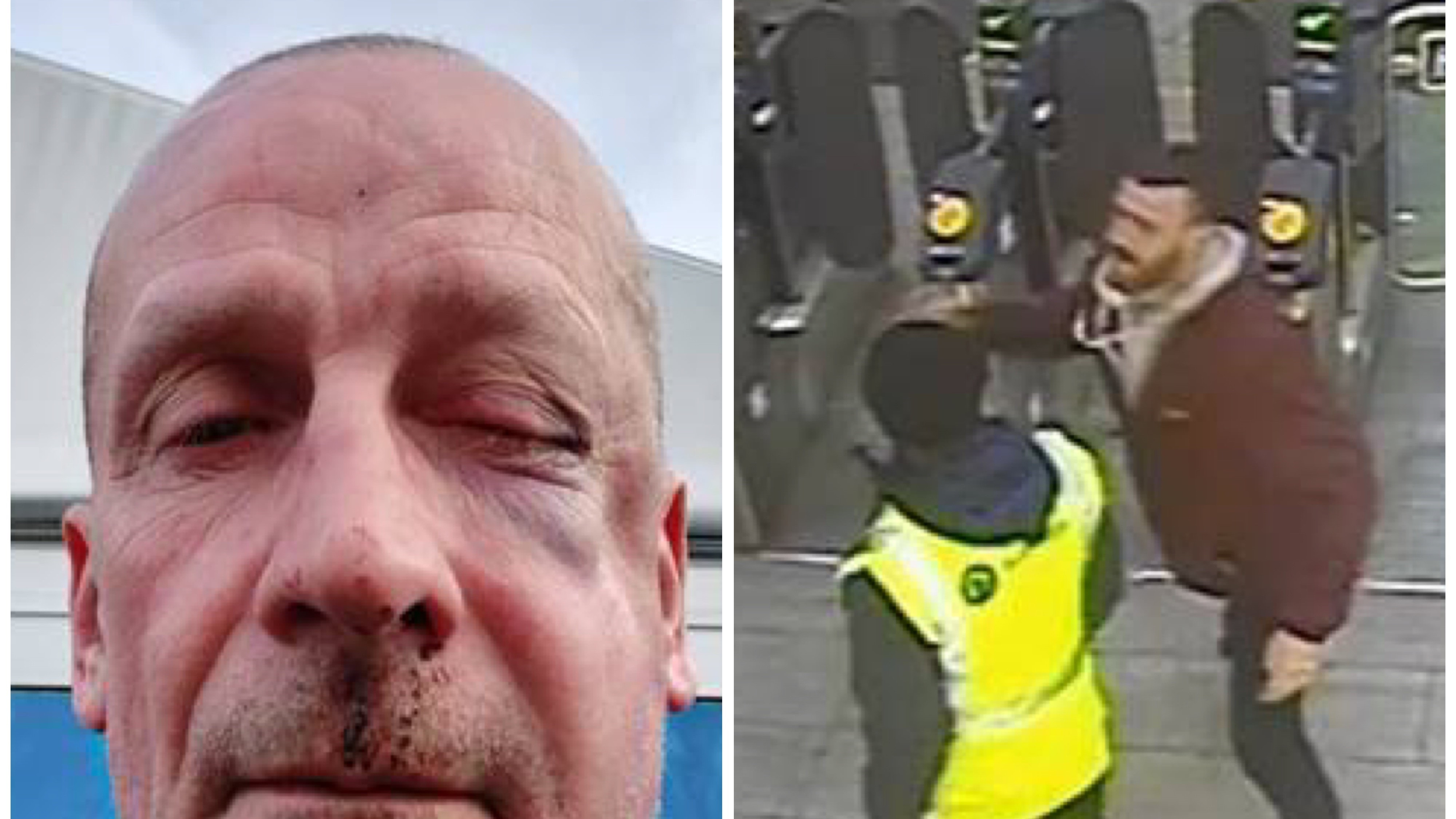 Colin Spicer injuries & CCTV-2